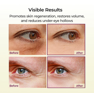 Revitalize Your Skin, Renew Your Confidence